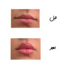 لیپ گلاس حجم دهنده آمپولی - Image 2